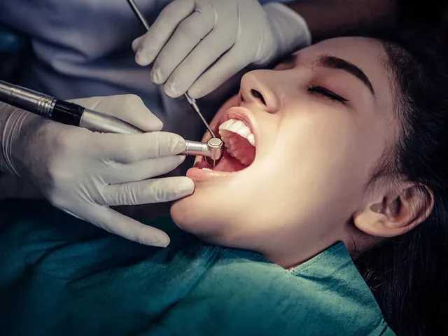 Why Choose Our Root Canal Treatment