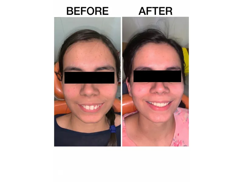 Dental treatment case 1