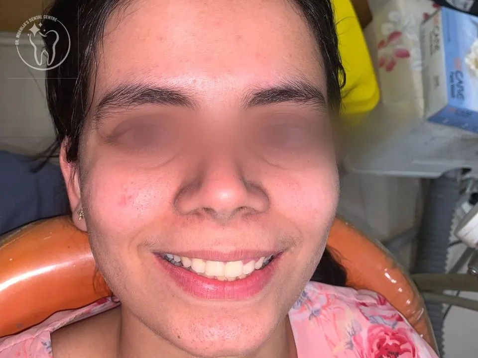 Before Treatment