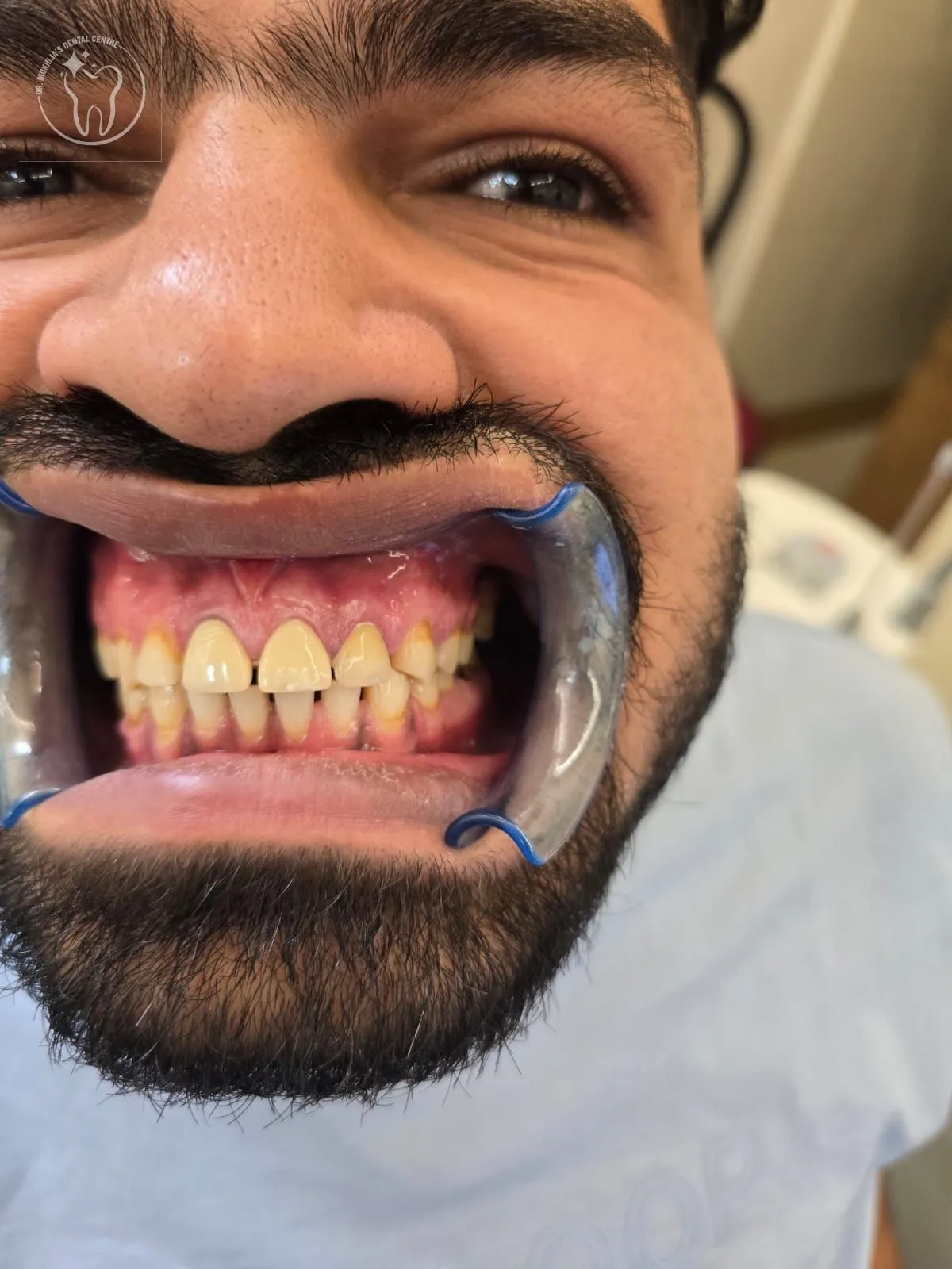 Dental treatment case