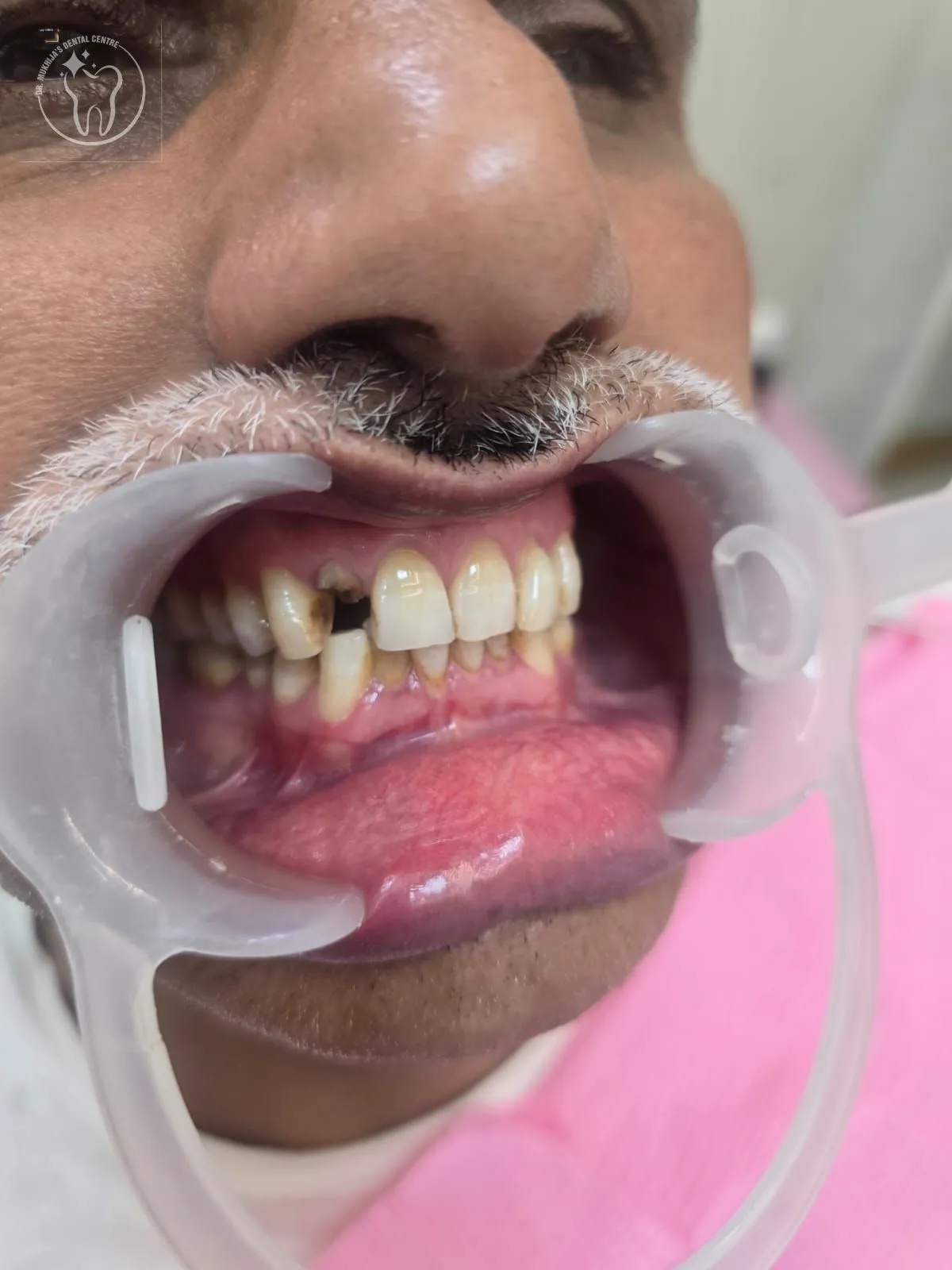 Dental treatment case