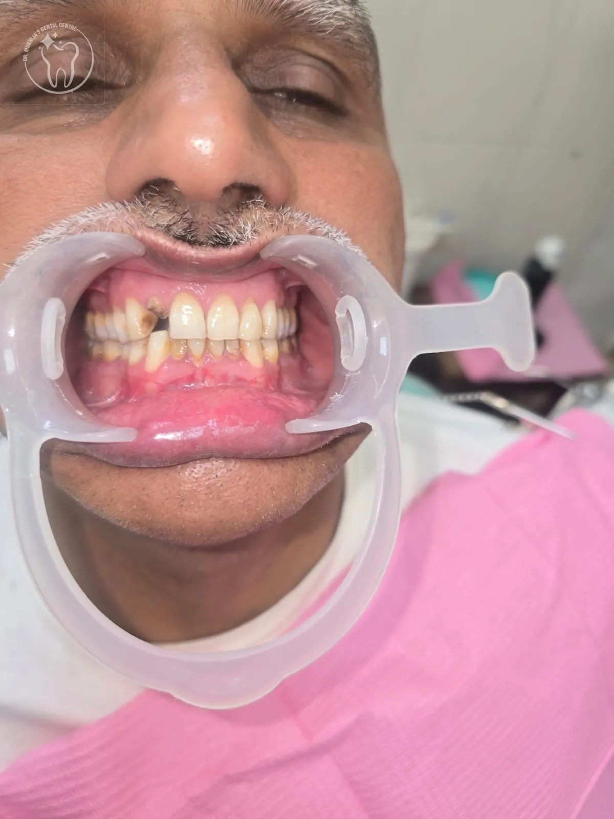 Dental treatment case