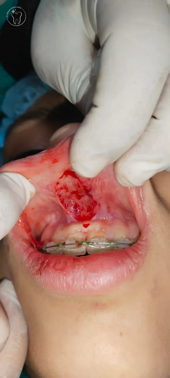 Maxillofacial surgery — oral surgical procedure